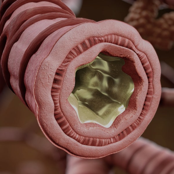 Malattie Infettive