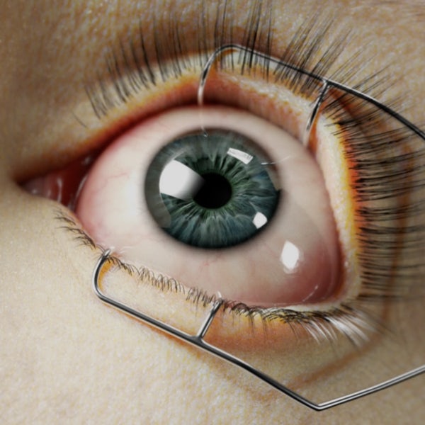 oftalmology