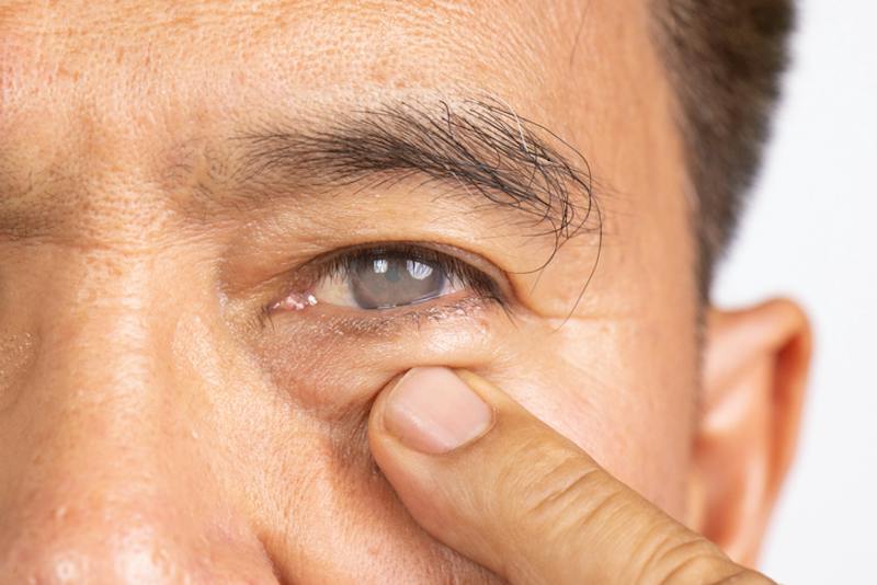 A man pointing to his eye