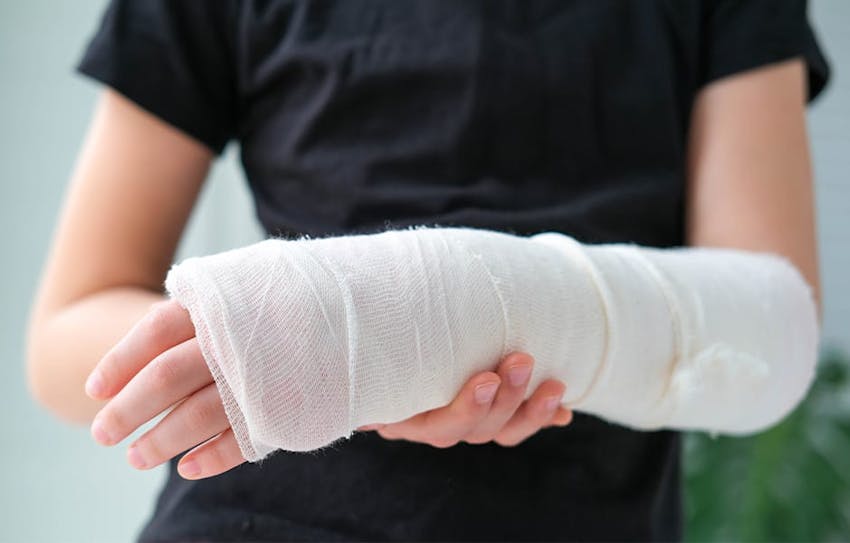 person showing their arm wrapped in a cast