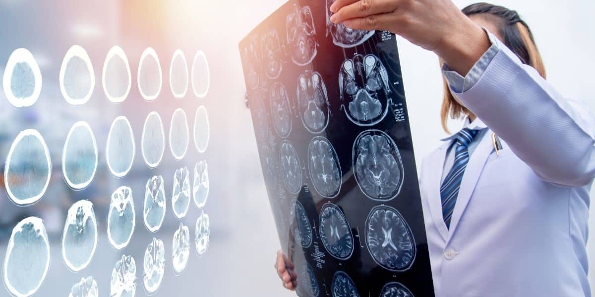 doctor brain injury