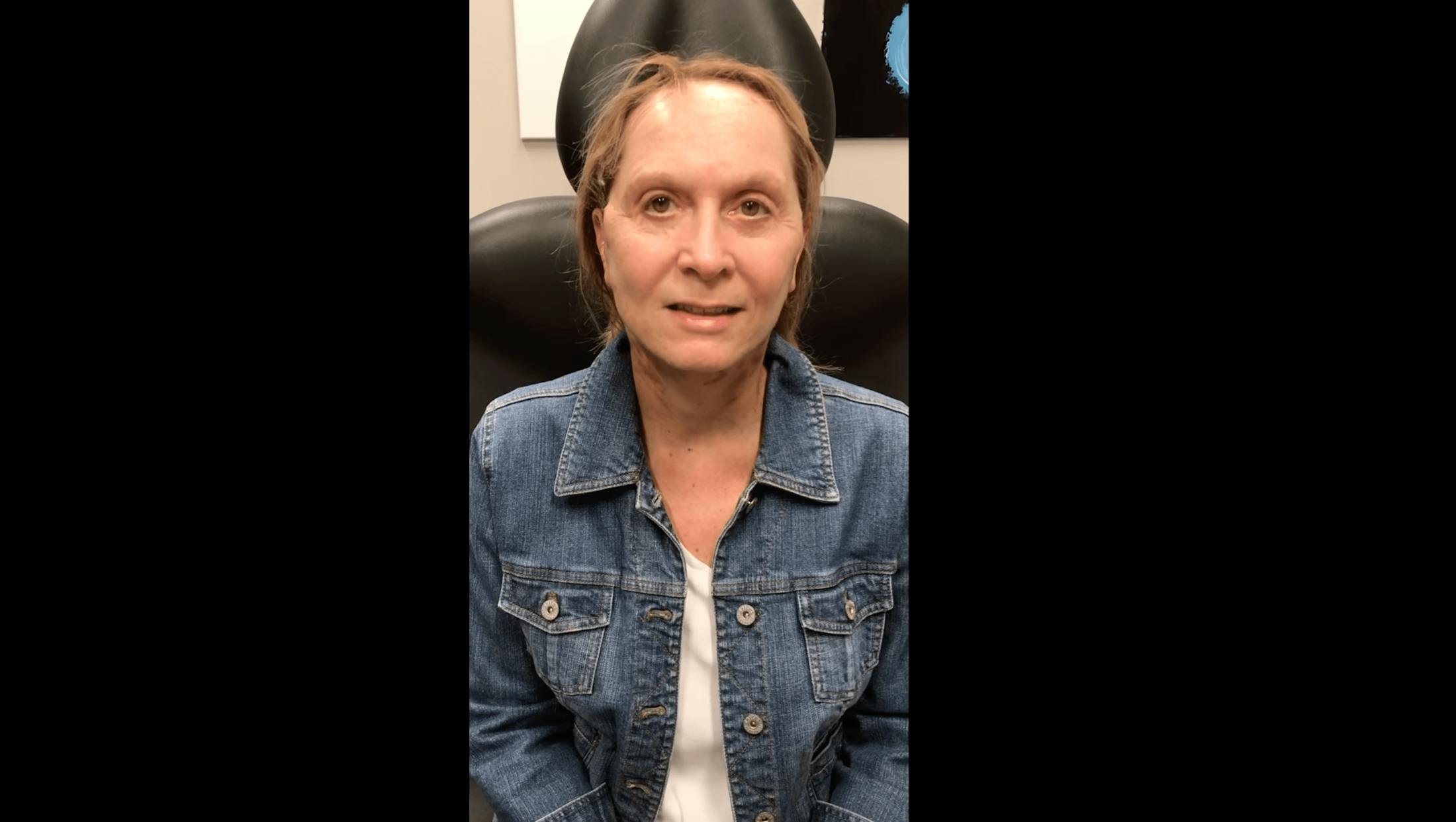 facelift patient
