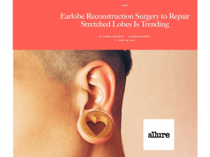 Dr. Ahn in Allure 
Earlobe Reconstruction Surgery to Repair Stretched Lobes Is Trending June 29, 2017