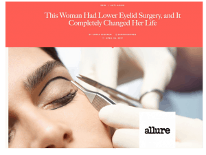 Dr. Ahn in Allure 
This Woman Had Lower Eyelid Surgery, and It Completely Changed Her Life April 24, 2017