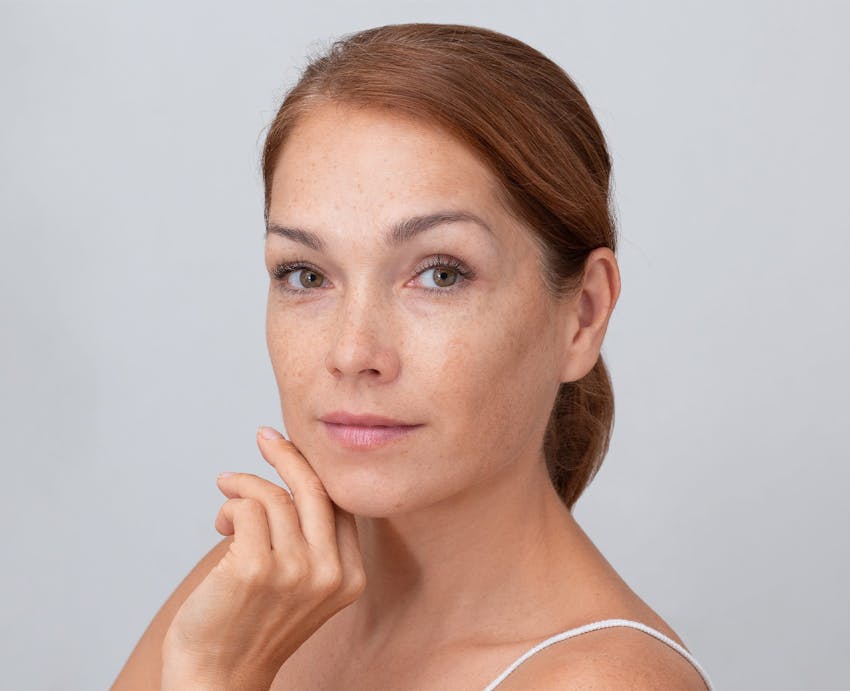 Woman with freckles