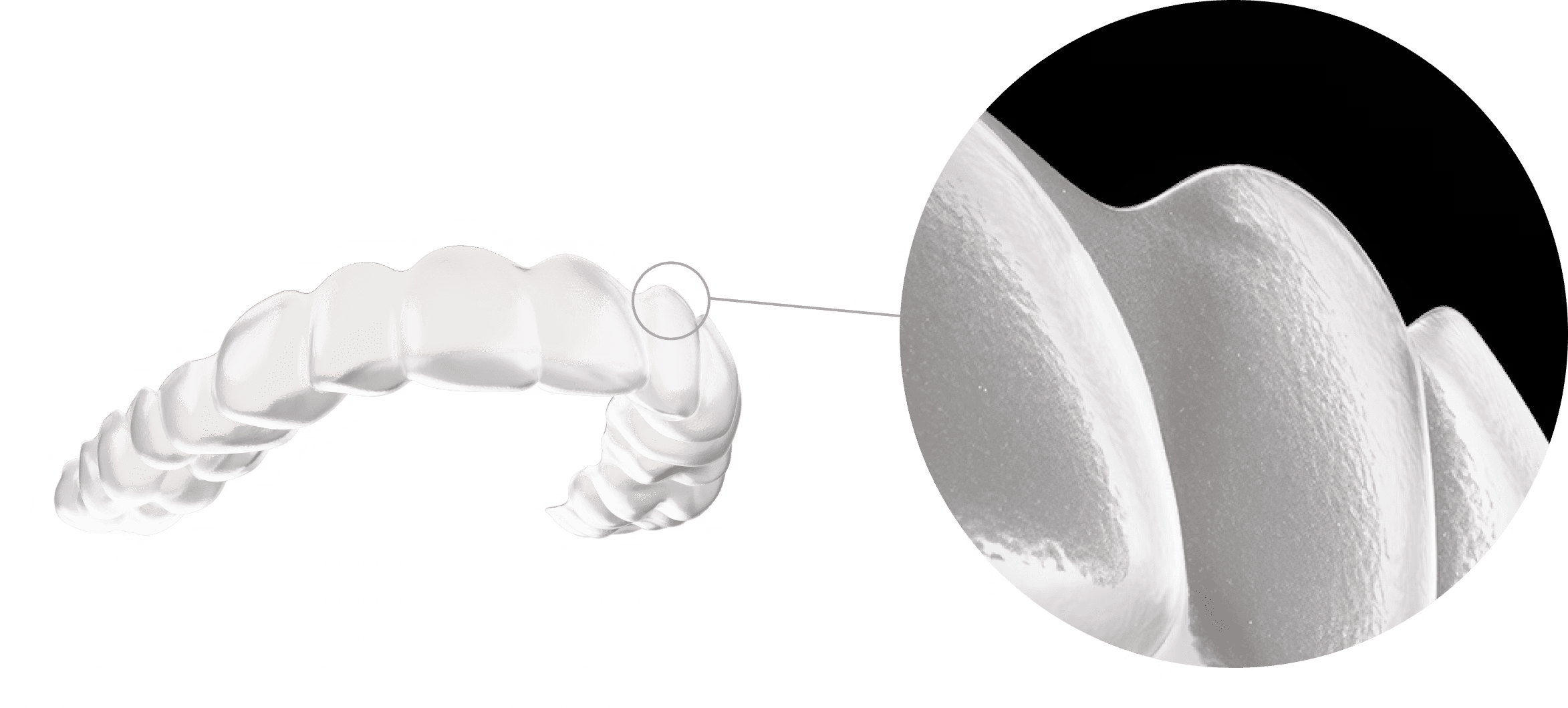 FXBright Aligners | OrthoFX
