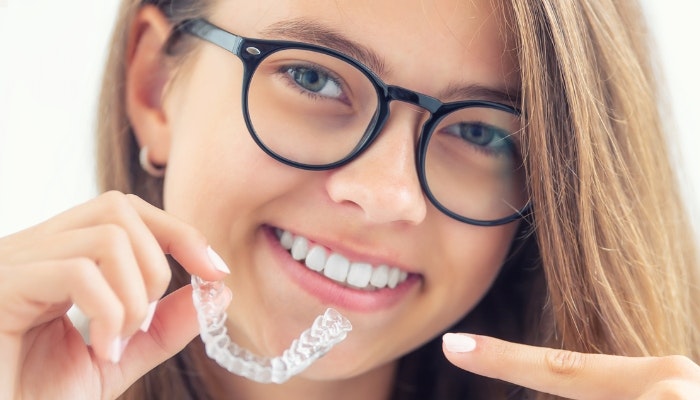 Invisalign Clear Aligners