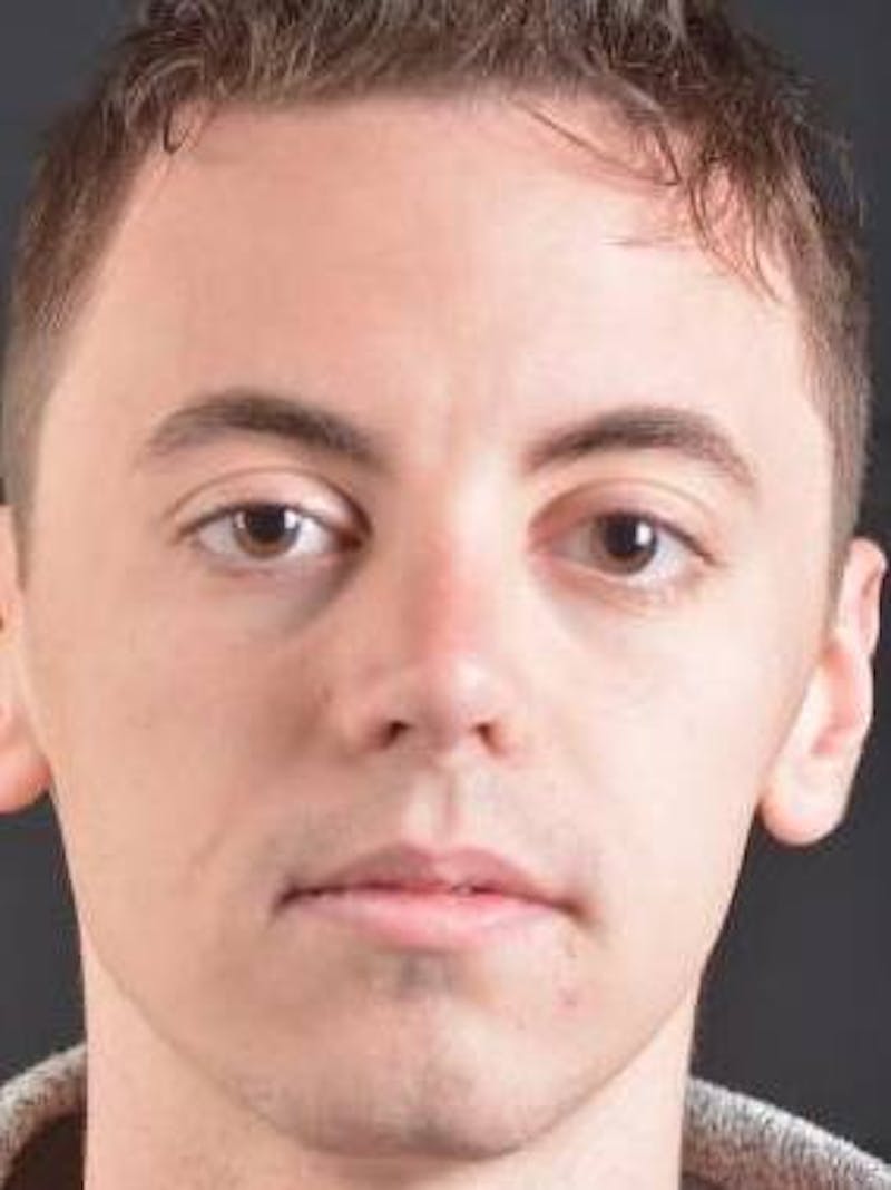 Rhinoplasty Before & After Gallery - Patient 572027 - Image 2