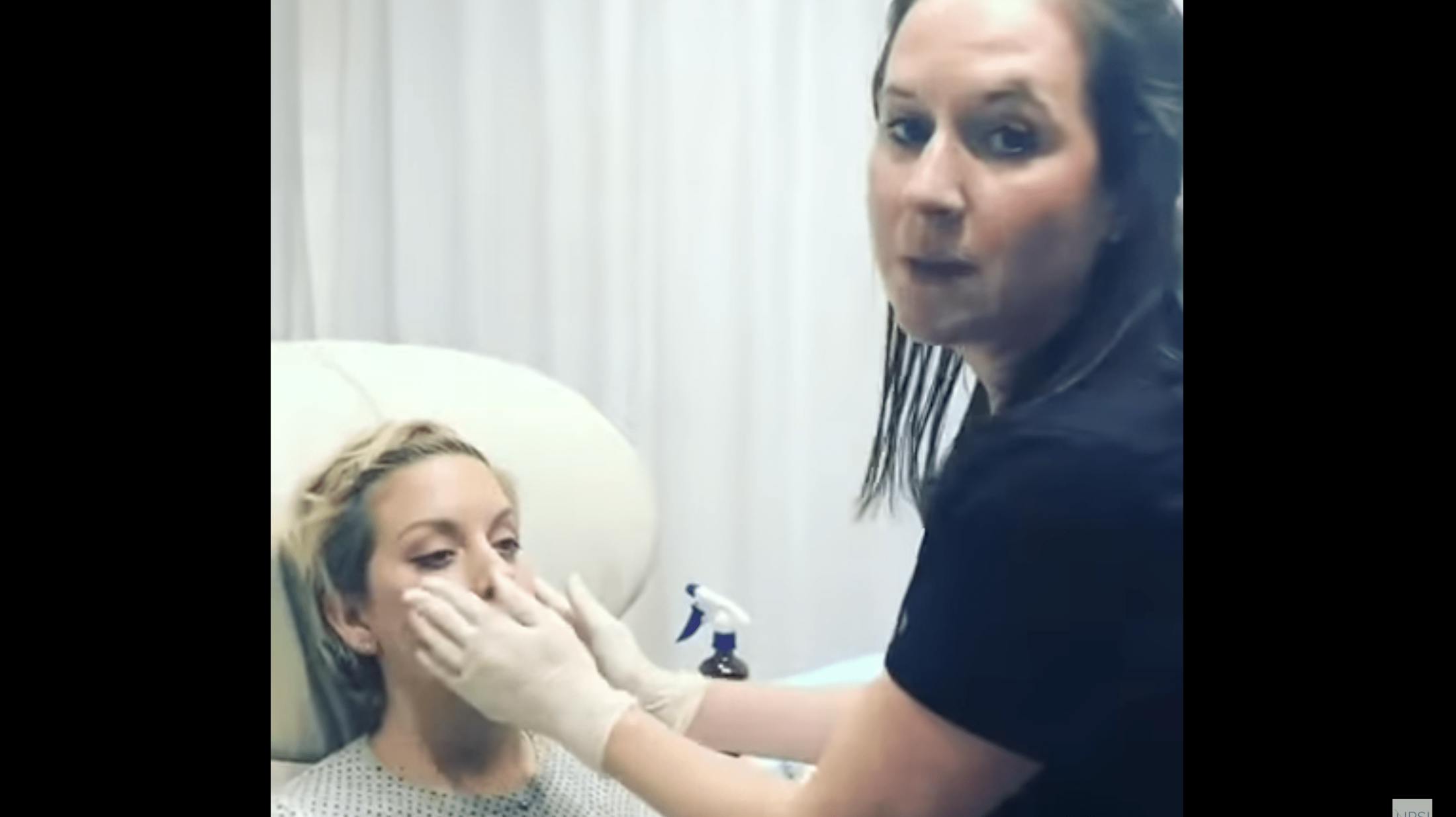 liquid facelift video