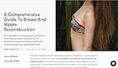 A Comprehensive Guide to Breast and Nipple Reconstruction