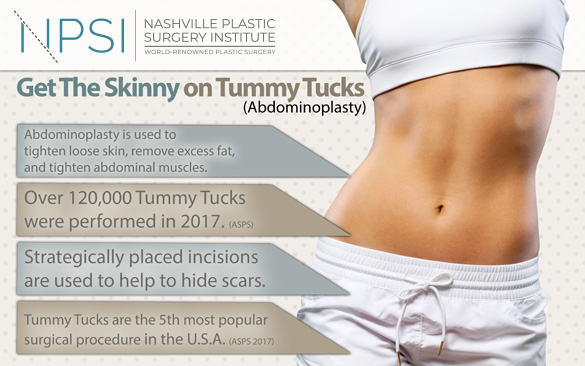 tummy tuck infographic