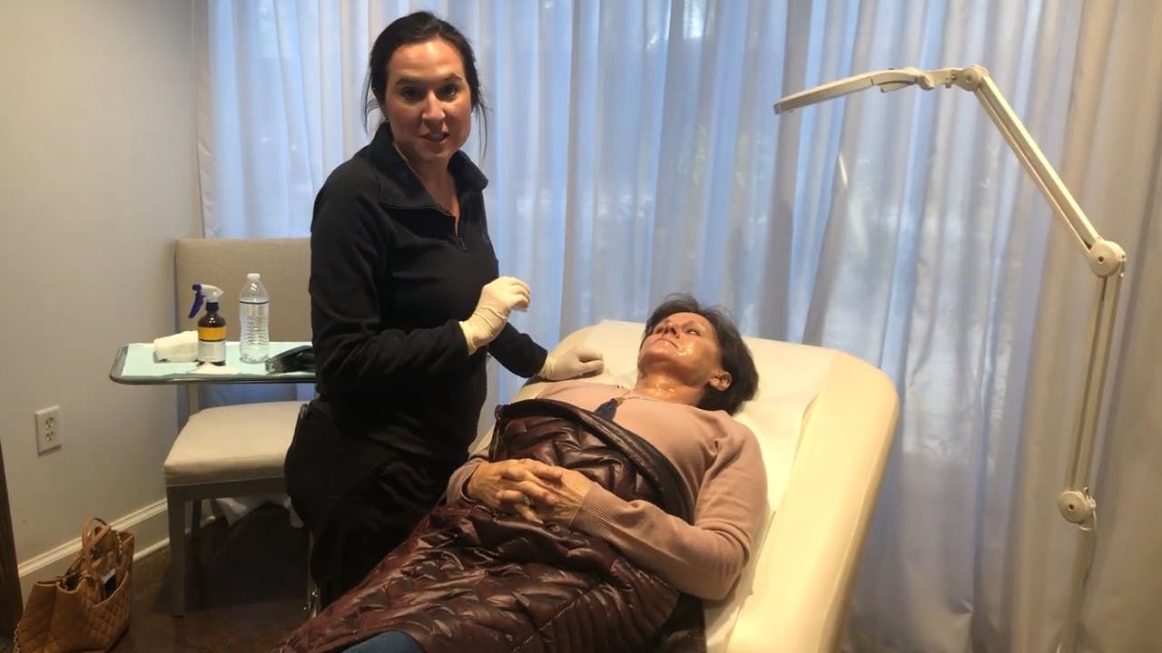 woman getting a microneedling treatment