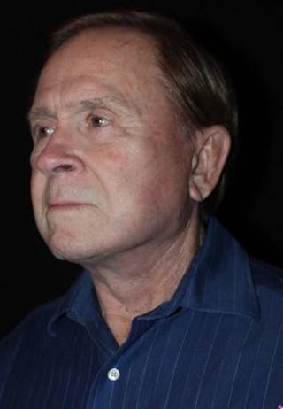 Facelift Before & After Gallery - Patient 295117 - Image 4