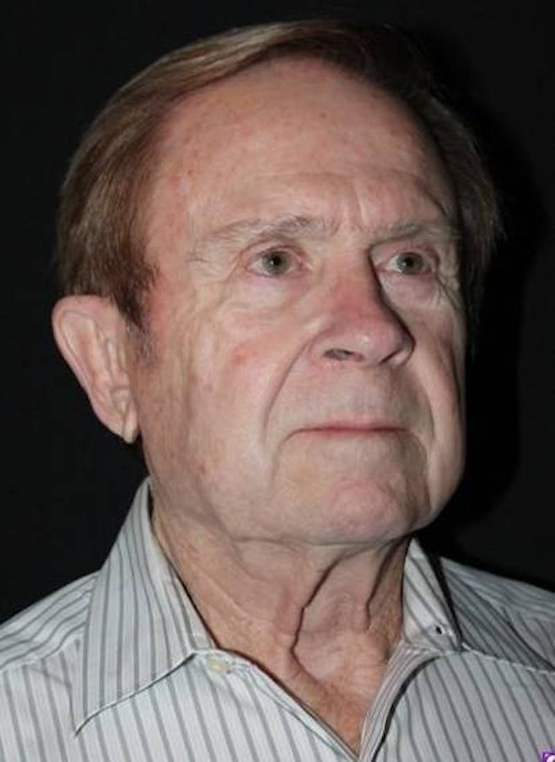 Facelift Before & After Gallery - Patient 295117 - Image 7