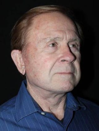 Facelift Before & After Gallery - Patient 295117 - Image 8