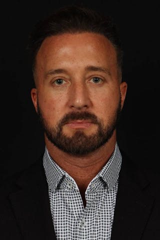 Blepharoplasty Before & After Gallery - Patient 292990 - Image 2