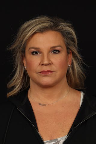 Facelift Before & After Gallery - Patient 449624 - Image 2