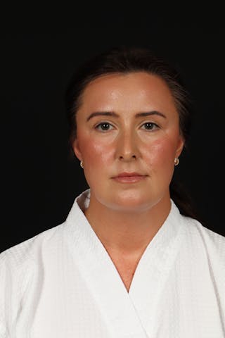 FaceTite Before & After Gallery - Patient 397122 - Image 2