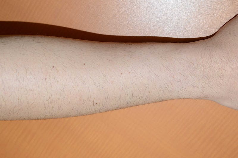 Special Cases Before & After Gallery - Patient 403316 - Image 1