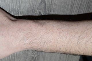 Special Cases Before & After Gallery - Patient 403316 - Image 4