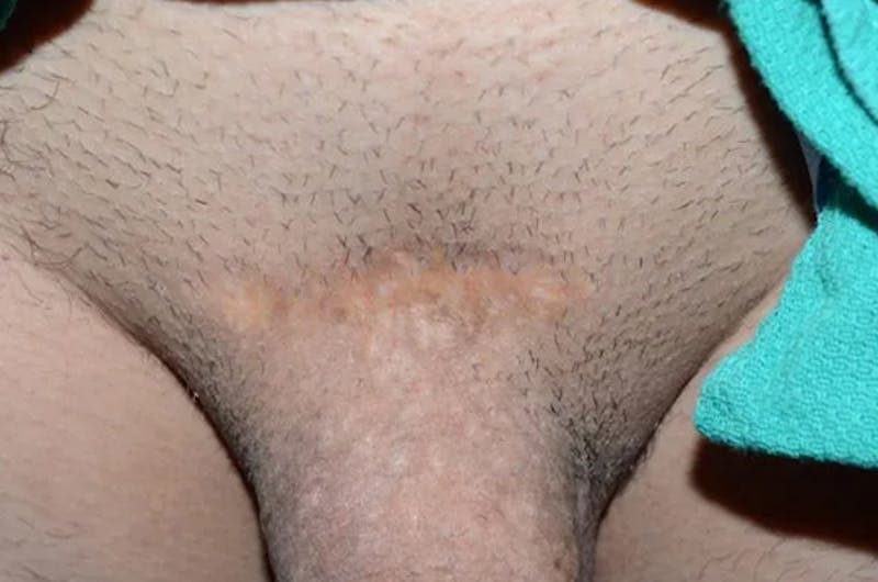 Special Cases Before & After Gallery - Patient 392863 - Image 1
