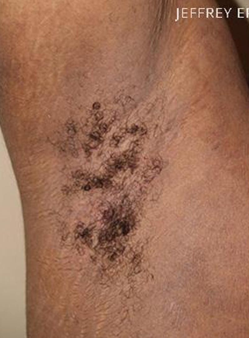 Special Cases Before & After Gallery - Patient 398443 - Image 1