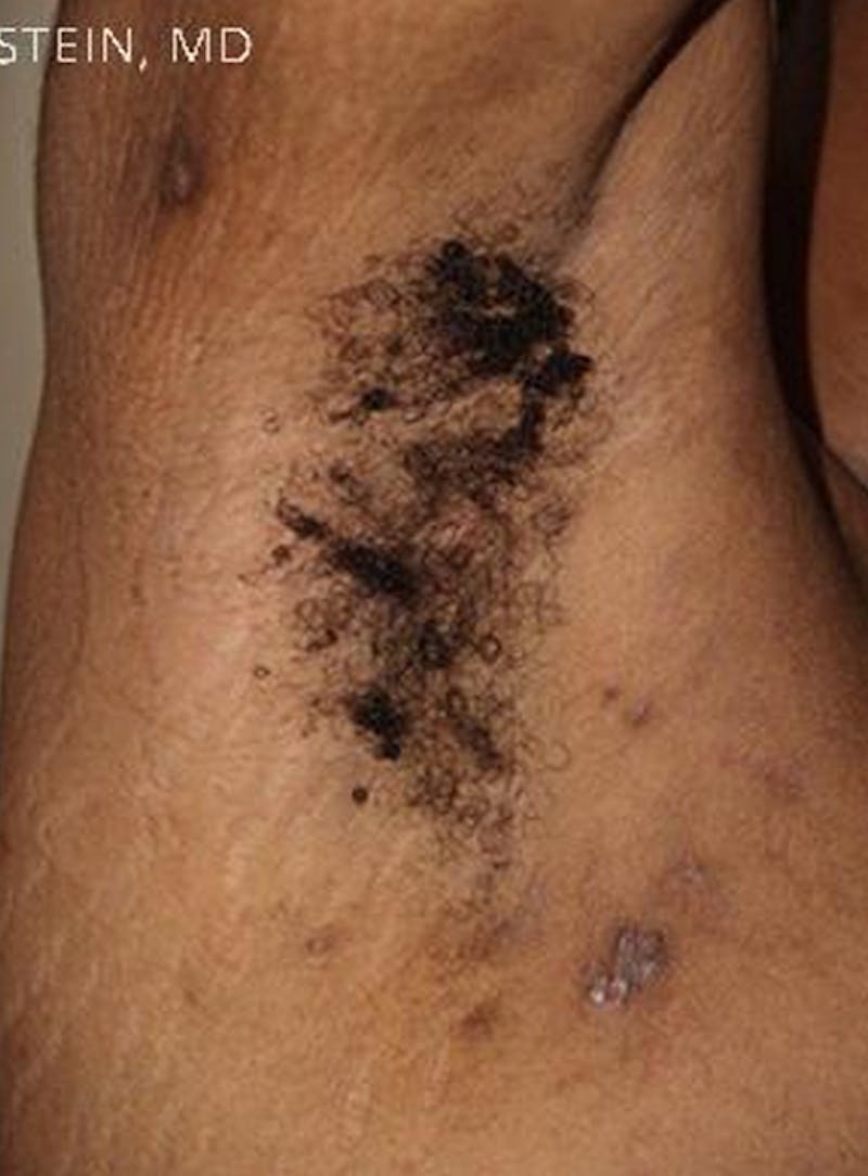 Special Cases Before & After Gallery - Patient 398443 - Image 2