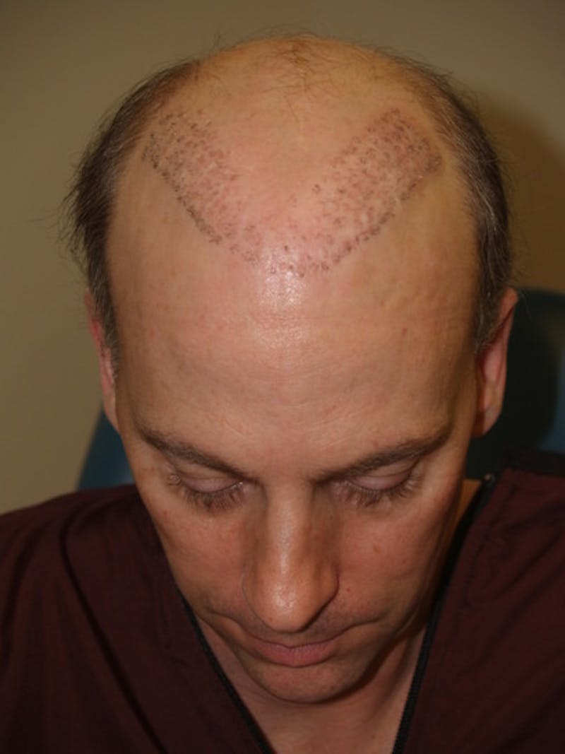 Special Cases Before & After Gallery - Patient 255551 - Image 1