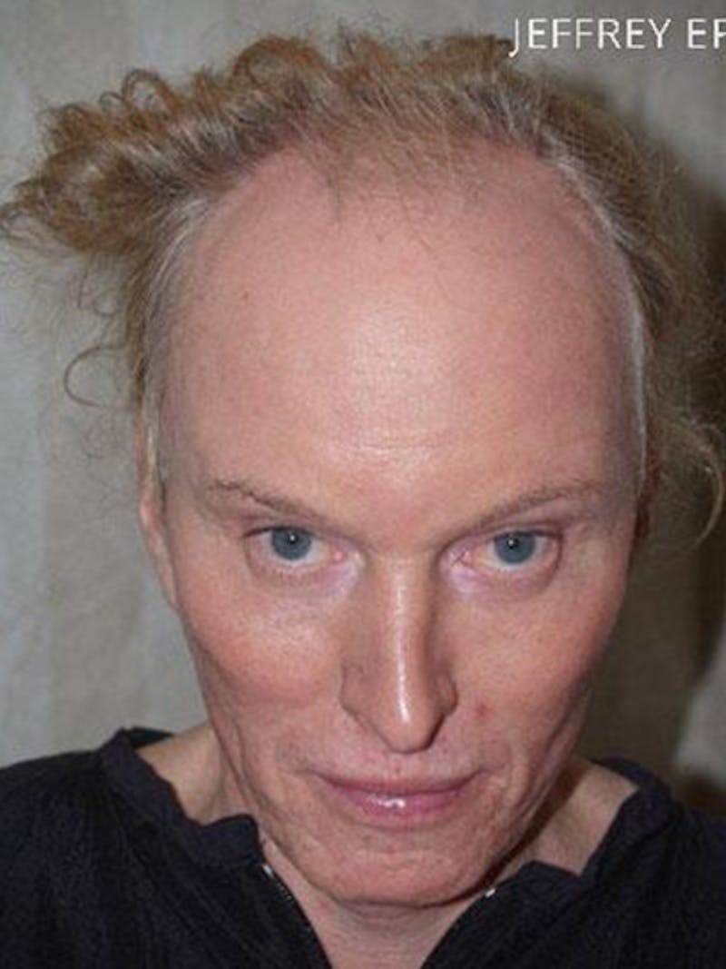 Special Cases Before & After Gallery - Patient 145966 - Image 1