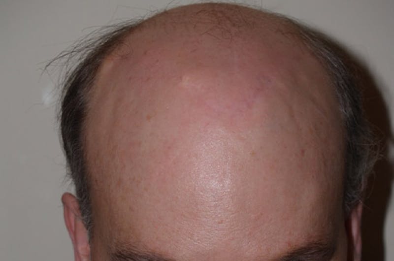 Special Cases Before & After Gallery - Patient 255551 - Image 8