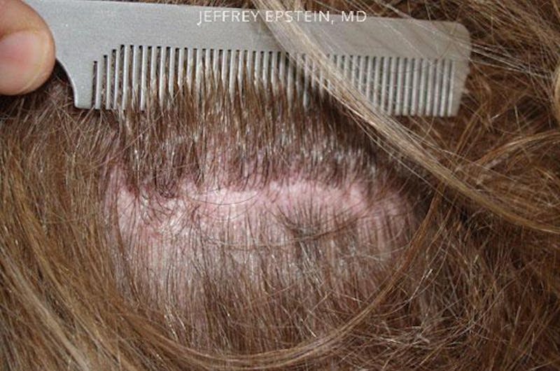 Special Cases Before & After Gallery - Patient 145966 - Image 8