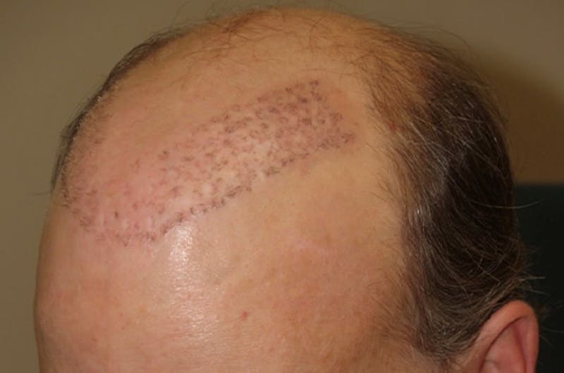 Special Cases Before & After Gallery - Patient 255551 - Image 9