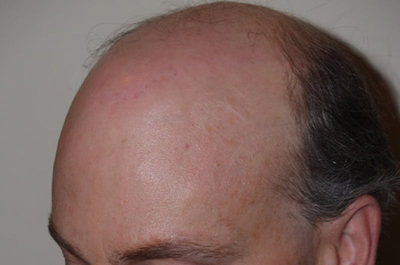 Special Cases Before & After Gallery - Patient 255551 - Image 10
