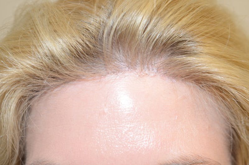 Special Cases Before & After Gallery - Patient 138476 - Image 2