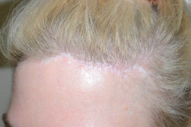 Special Cases Before & After Gallery - Patient 138476 - Image 3