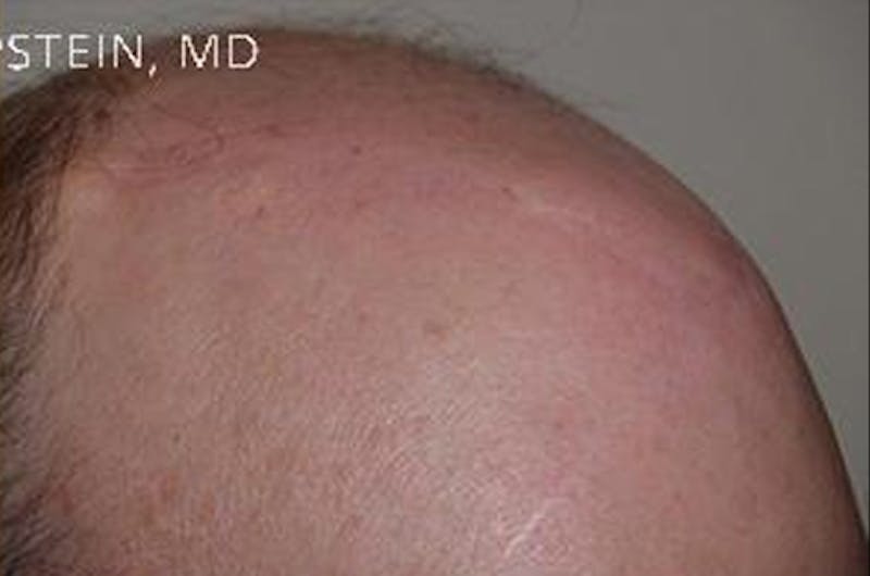 Special Cases Before & After Gallery - Patient 255551 - Image 12