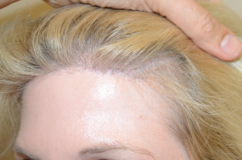 Special Cases Before & After Gallery - Patient 138476 - Image 4
