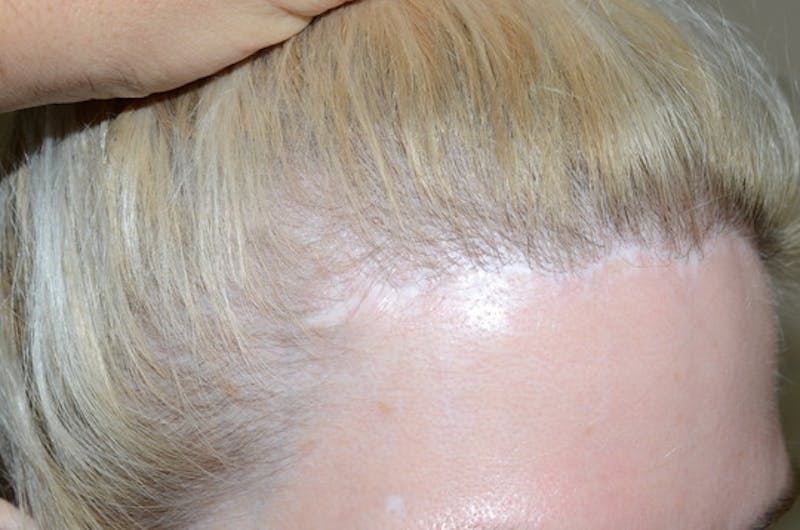 Special Cases Before & After Gallery - Patient 138476 - Image 5
