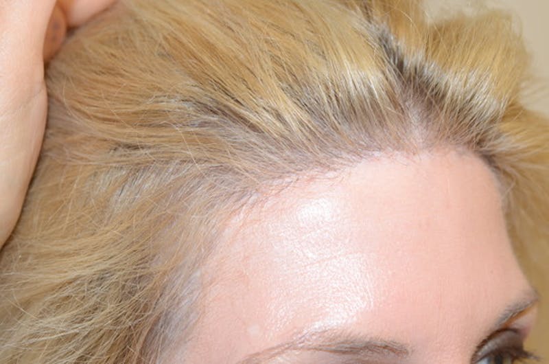 Special Cases Before & After Gallery - Patient 138476 - Image 6