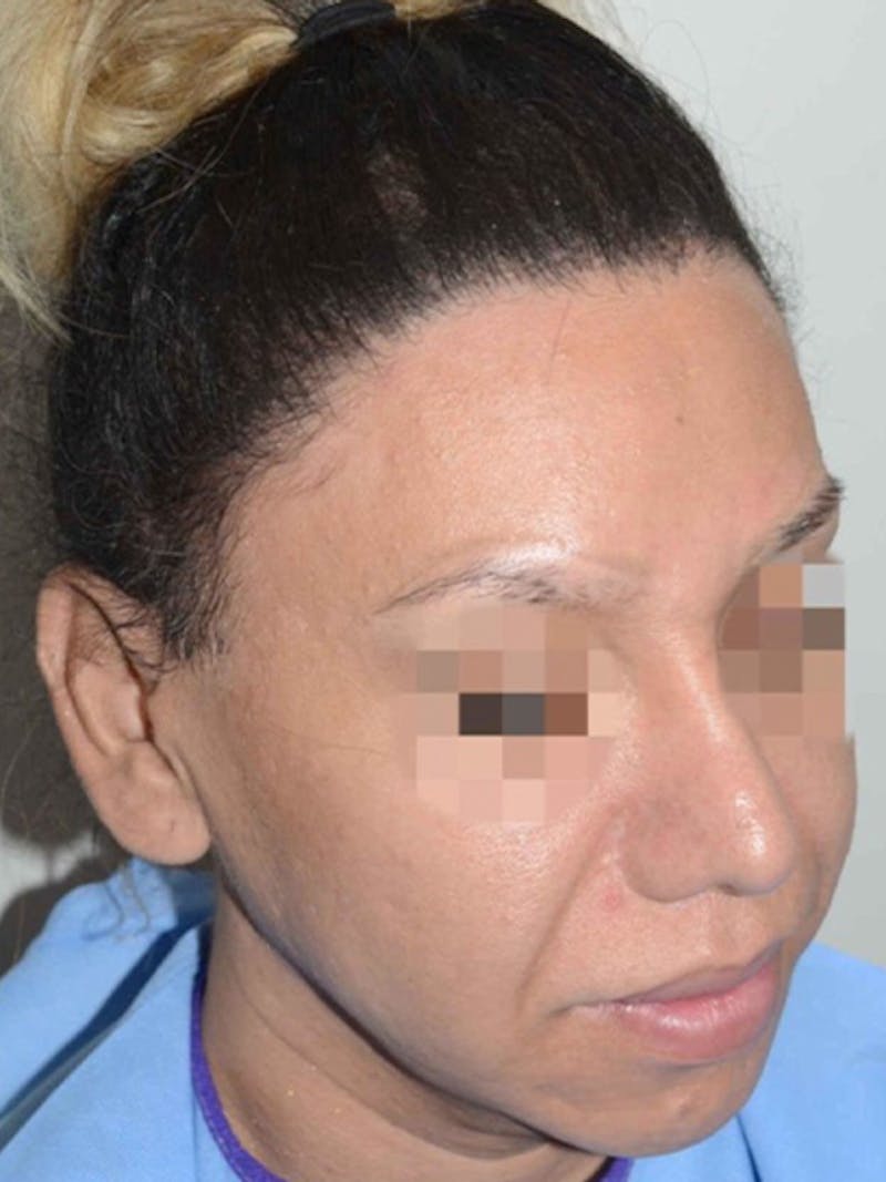 Special Cases Before & After Gallery - Patient 151257 - Image 6