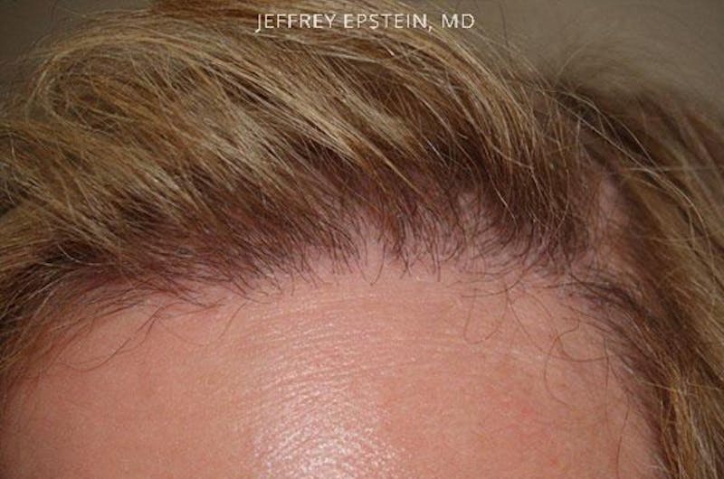 Special Cases Before & After Gallery - Patient 145966 - Image 7