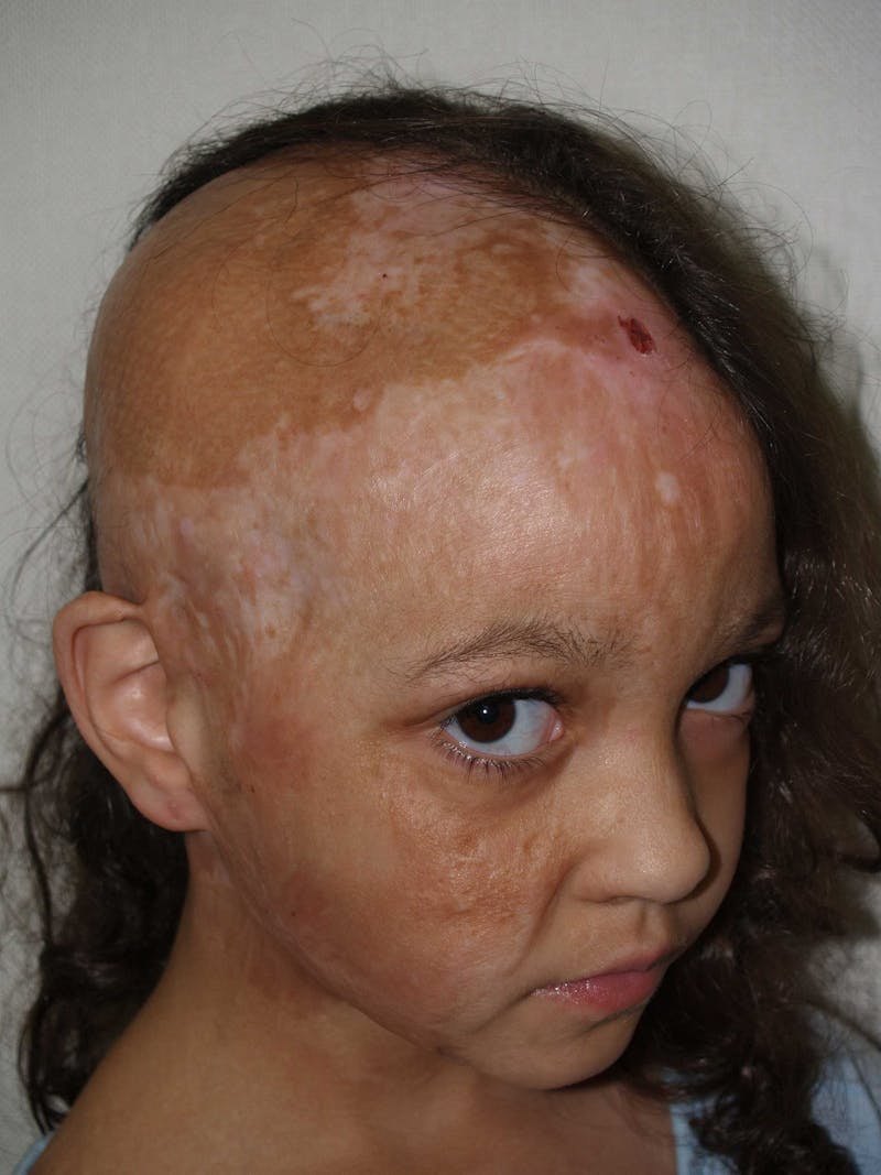 Special Cases Before & After Gallery - Patient 307019 - Image 3