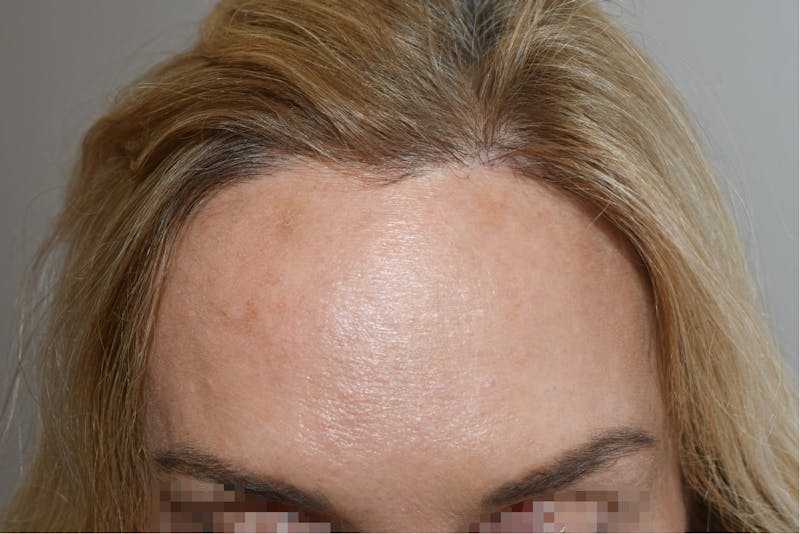 Special Cases Before & After Gallery - Patient 101485 - Image 2
