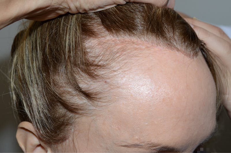 Special Cases Before & After Gallery - Patient 101485 - Image 3