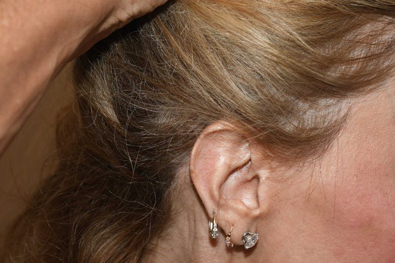 Special Cases Before & After Gallery - Patient 101485 - Image 6