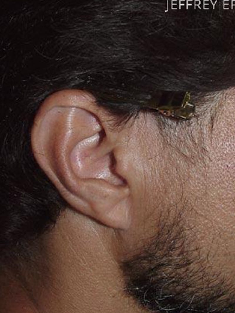 Special Cases Before & After Gallery - Patient 103205 - Image 1