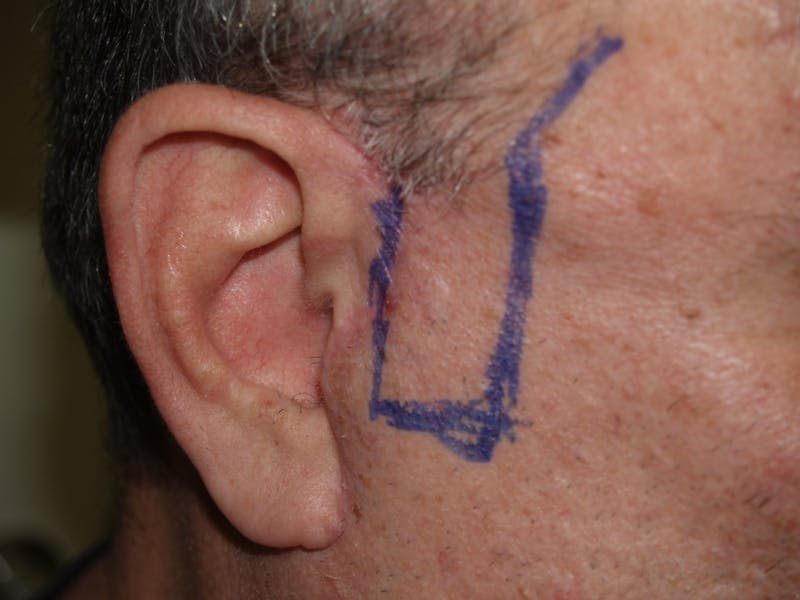 Special Cases Before & After Gallery - Patient 389414 - Image 1