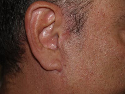 Special Cases Before & After Gallery - Patient 385052 - Image 2