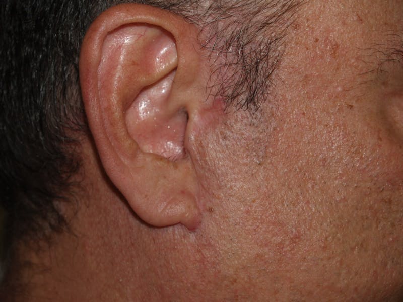 Special Cases Before & After Gallery - Patient 389414 - Image 2