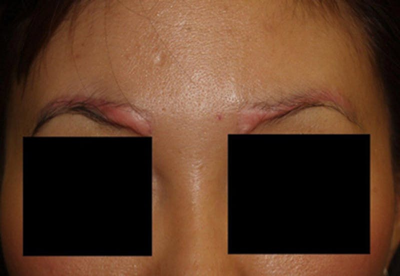 Special Cases Before & After Gallery - Patient 362558 - Image 1